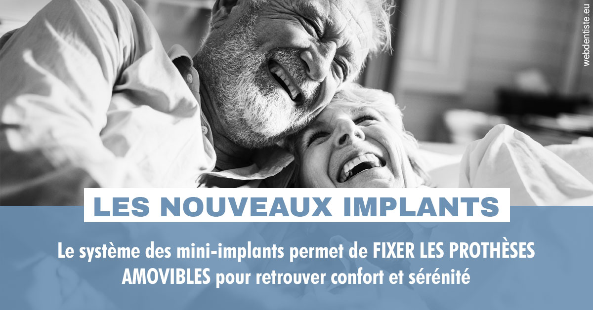 https://dr-nizard-veronique.chirurgiens-dentistes.fr/Les nouveaux implants 2