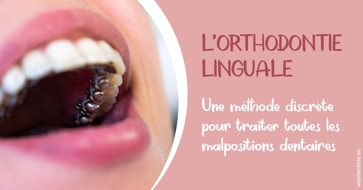 https://dr-nizard-veronique.chirurgiens-dentistes.fr/L'orthodontie linguale 2
