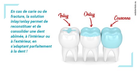https://dr-nizard-veronique.chirurgiens-dentistes.fr/L'INLAY ou l'ONLAY