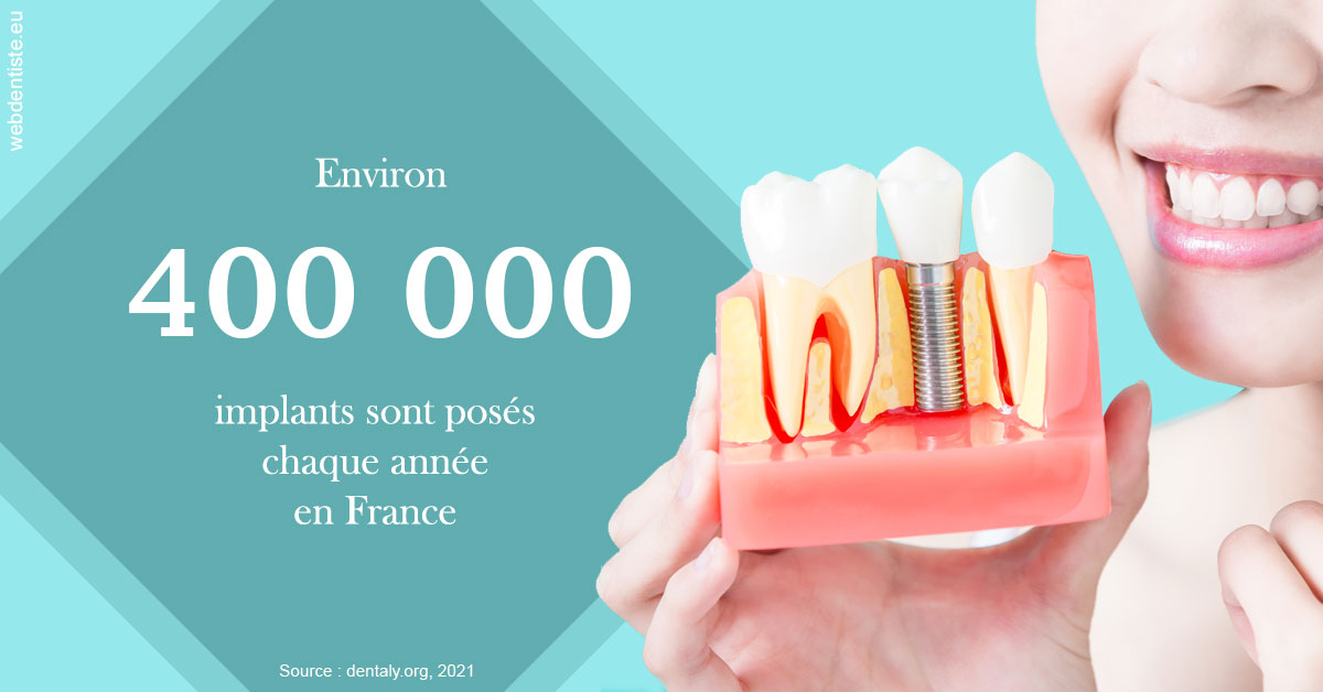 https://dr-nizard-veronique.chirurgiens-dentistes.fr/Pose d'implants en France 2